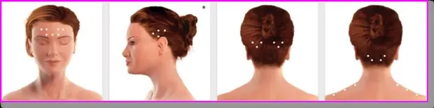 Baş Ağrısı Tedavi Süreci