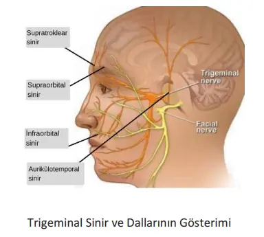 Baş Ağrısı Tedavi Süreci
